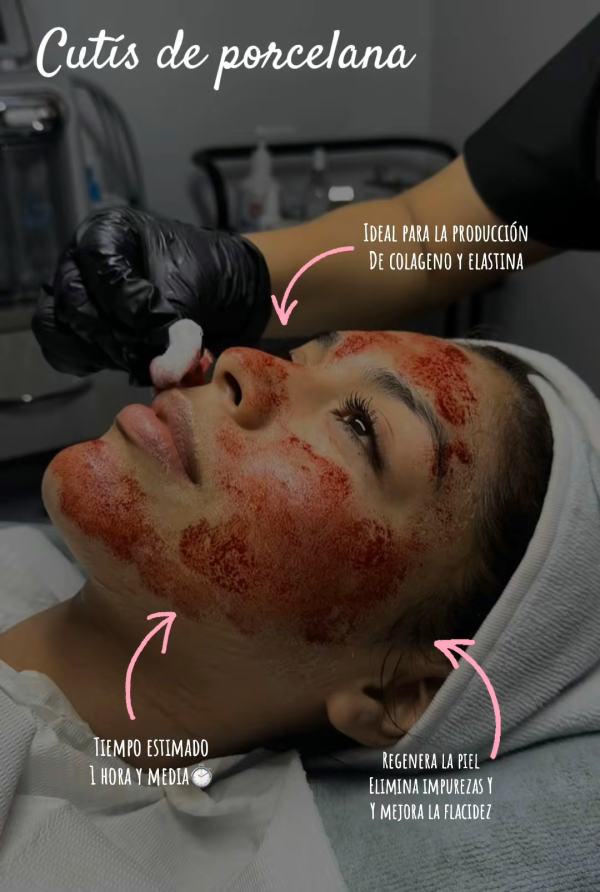 Tratamiento Cutis de Porcelana