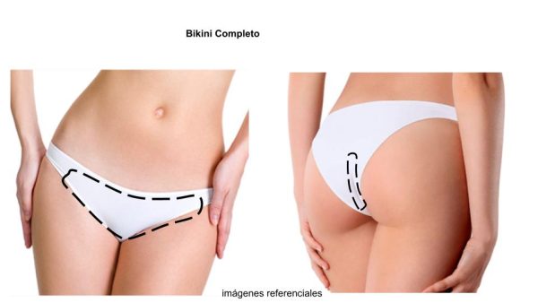 D.L. Bikini Completo