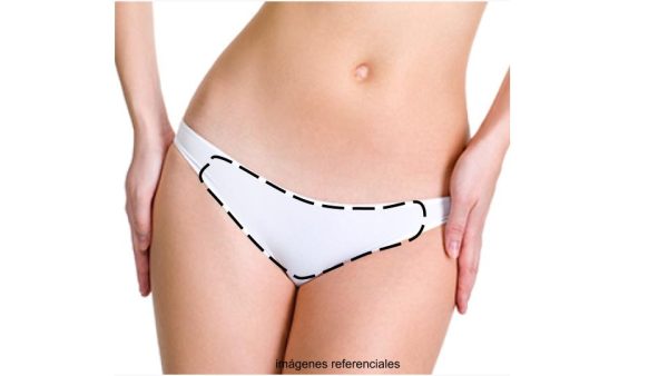 DL Bikini Brasilero Normal